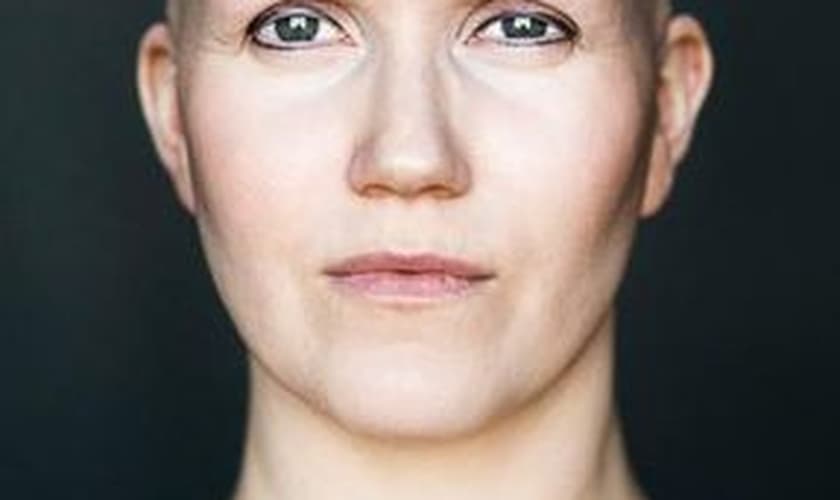 Mulheres que sofrem com doença que cai os cabelos participam de projeto de fotógrafa islandesa