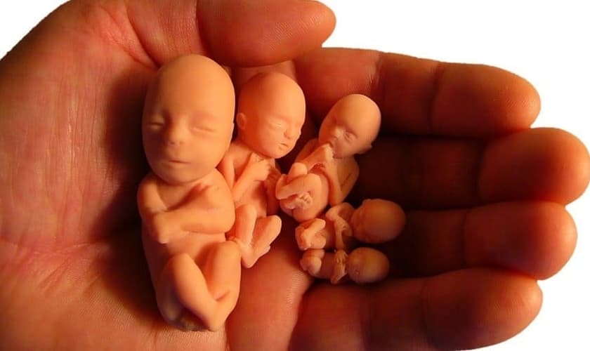 Aborto. (Foto: Conexão Eclésia)