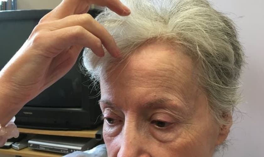 Após levar facadas na cabeça durante um assalto, Angela Burks causou impacto ao declarar que está preparada para perdoar o criminoso. (Foto: Reprodução/BBC)