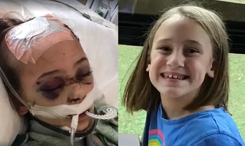 Chloe Clark foi diagnosticada com meningite bacteriana. (Imagem: Facebook)