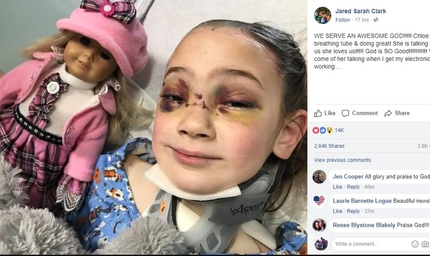 Uma foto da garota já acordada foi publicada pelo pai no hospital. (Foto: Facebook)