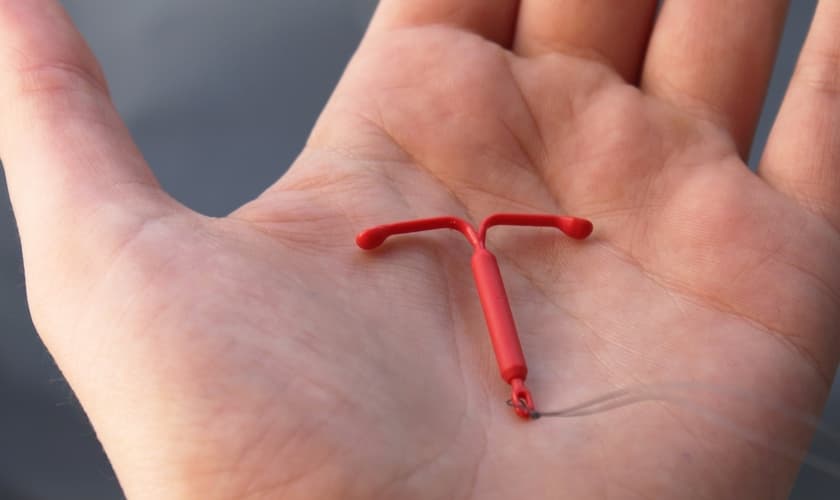 O DIU libera substâncias que tornam o útero inóspito para o espermatozóide, impedindo a fecundação. (Foto: Reprodução)