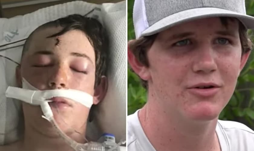 : Caleb quando estava em como e hoje, recuperado. (Foto: Reprodução/WTSP)