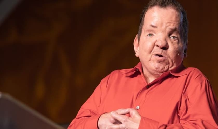 Dorsey nasceu com síndrome de Apert, mas superou a deficiência e se tornou um evangelista. (Foto: Dorsey Ross Ministries)