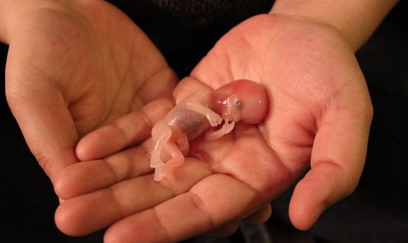 Feto de 12 semanas e 5 dias. (Foto: Reprodução / LifeNews)