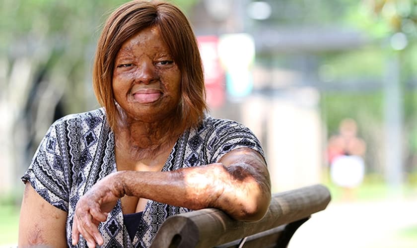 Kechi Okwuchi sobreviveu a uma queda de avião em 2005 na Nigéria. (Foto: Daily Word)