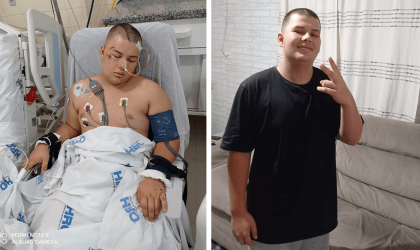 Nathan, de 16 anos, sofreu um grave acidente ao cair de uma bicicleta. (Foto: Reprodução / Lance Notícias)