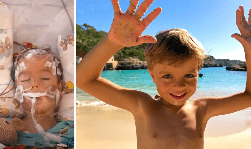 Blake após cirurgia, e hoje completamente restaurado. (Foto: Reprodução / Facebook)