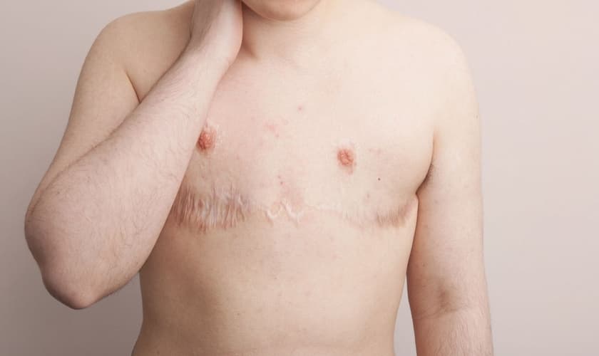 mbar, atualmente com 21 anos. Começou o tratamento hormonal aos 17, fez mastectomia e histerectomia aos 18. “Para mim a transição foi uma espécie de autoflagelação, estava tentando destruir a pessoa que eu era”. (Foto: Laura Dodsworth)