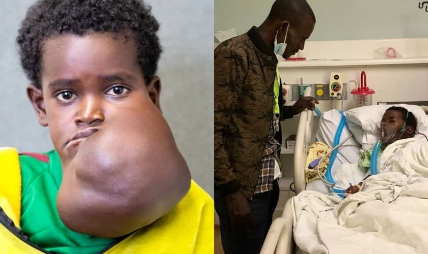 O pai Matios e a filha Haile foram levados a Nova York para a cirurgia de retirada do tumor. (Foto: Reprodução/ Facebook Vascular Waner Children's).