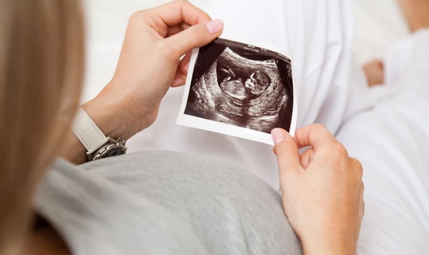 Até janeiro de 2021, mais de 62 milhões de abortos foram realizados nos EUA, desde sua legalização. (Foto: Shutterstock)