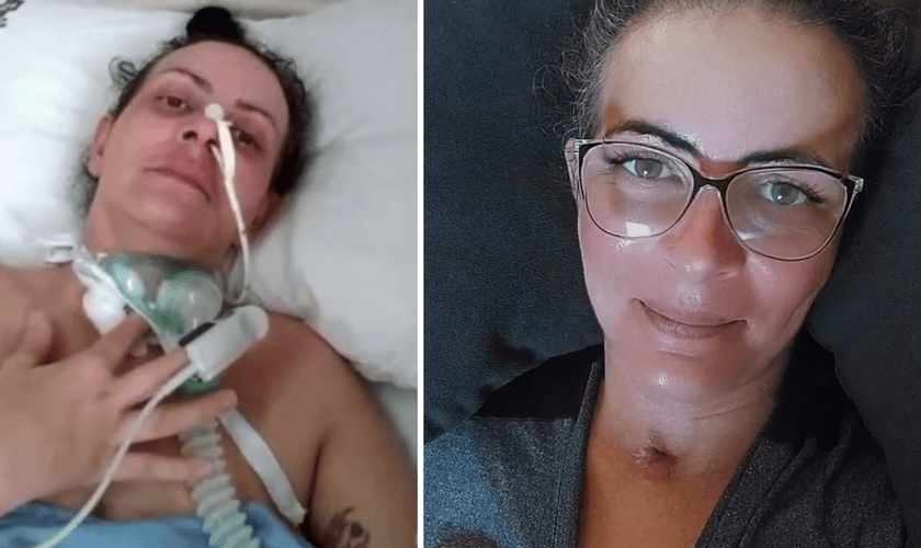 Debora D'Iasi durante internação e hoje. (Foto: Arquivo pessoal)