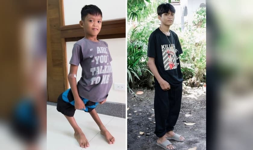 Aldrin ganhou uma cirurgia do hospital do atleta cristão Tim Tebow, nas Filipinas. (Foto: Instagram/Tim Tebow).