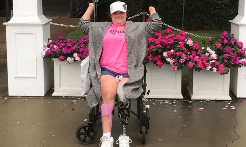 Wyndi Adkins sofreu complicações após uma cirurgia para aliviar enxaquecas. (Foto: Godfundme/Wyndi Adkins).