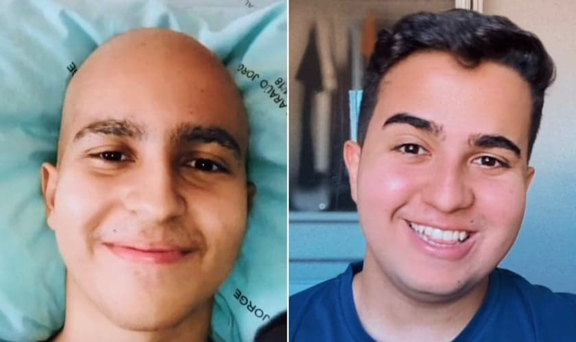 Lucas Teodoro antes e depois do câncer. (Foto: Reprodução/Instagram/Lucas Teodoro)